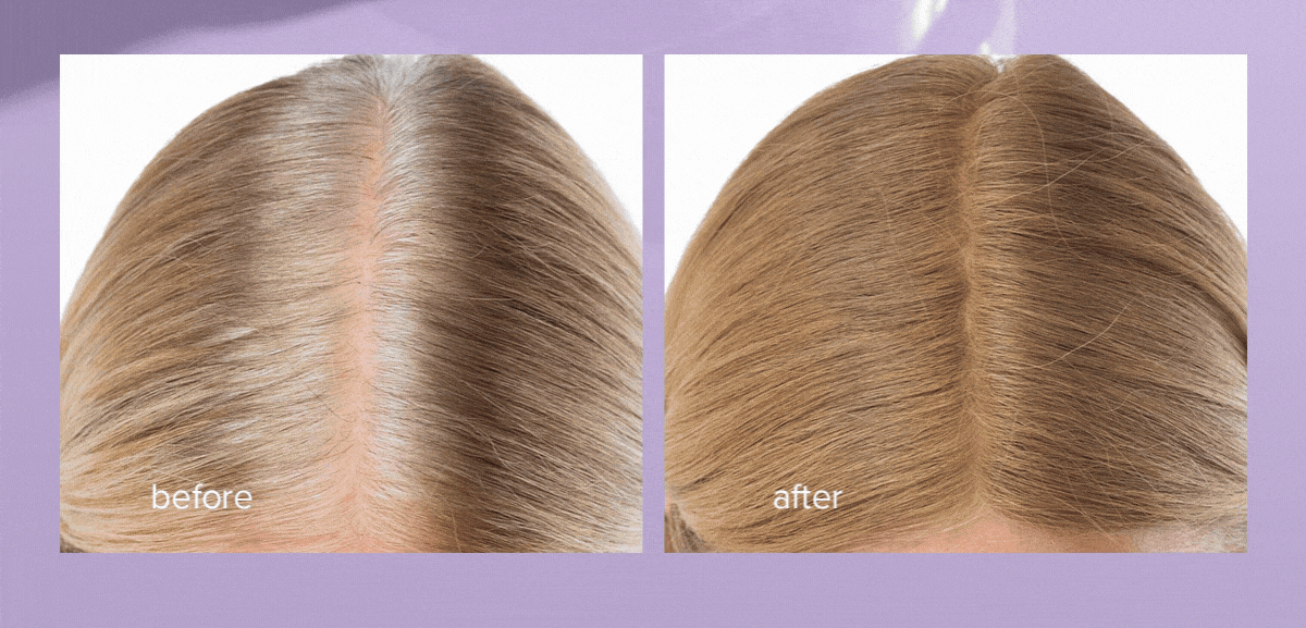Before/After